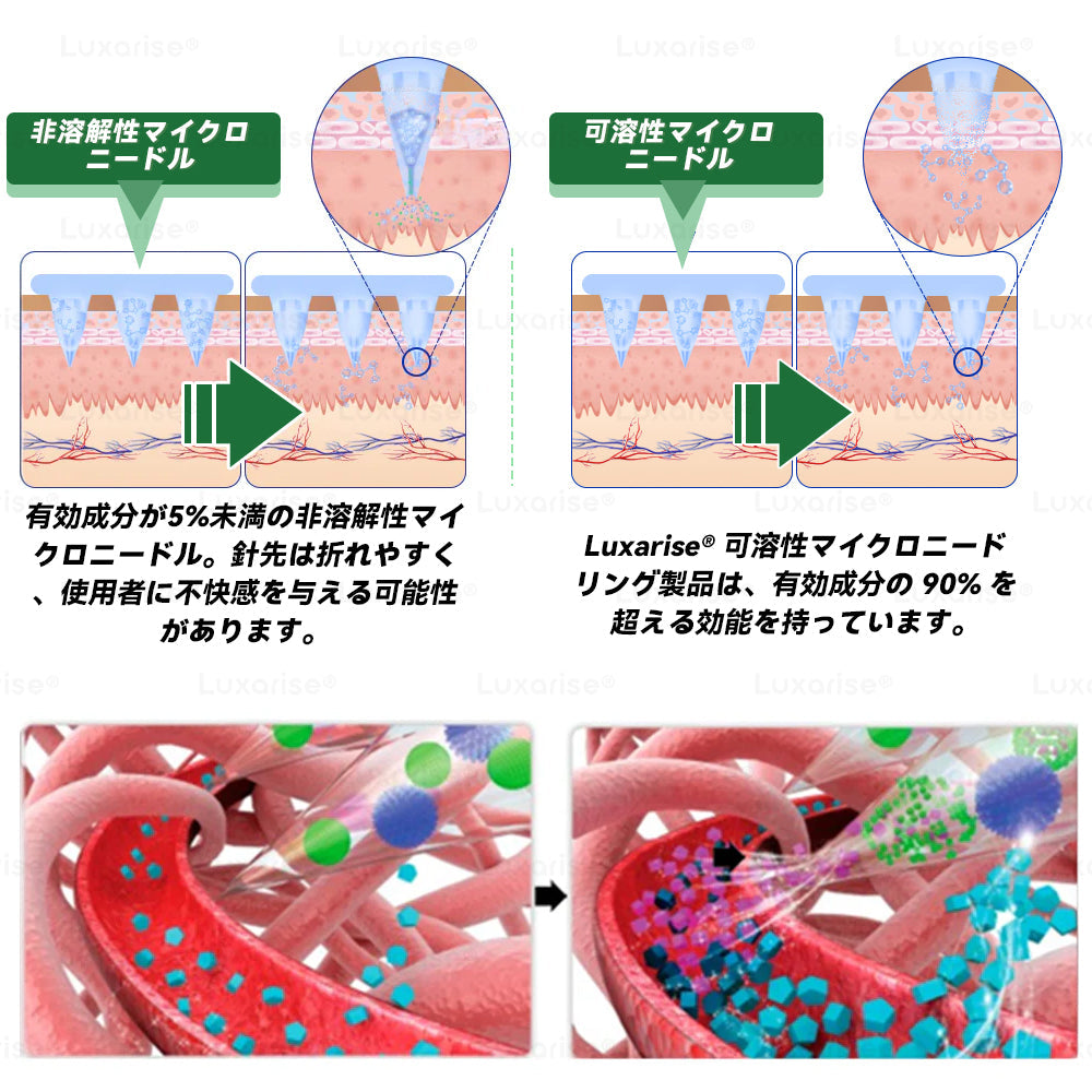 🔖公式ストア Luxarise® モリンガ＆ベルベリン 10-IN-1 高機能ナノマイクロニードルパッチ（1日1回、7日で変化を実感） 肥満・糖尿病・睡眠時無呼吸症候群・関節の悩み向け